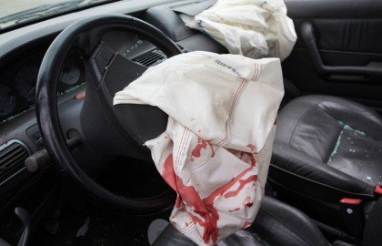 נזק גוף מטיפול דרך ברכב – תאונת דרכים ?